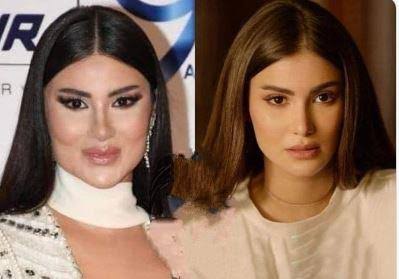 هدى الأتربي ترد على اتهامها بتشويه وجهها بعمليات التجميل